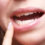 علائم پس زدن ایمپلنت - دکتر وفااله صحرایی