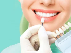 فرق لمینت و کامپوزیت - دکتر وفااله صحرایی