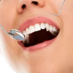 هزینه کامپوزیت دندان - دکتر وفااله صحرایی